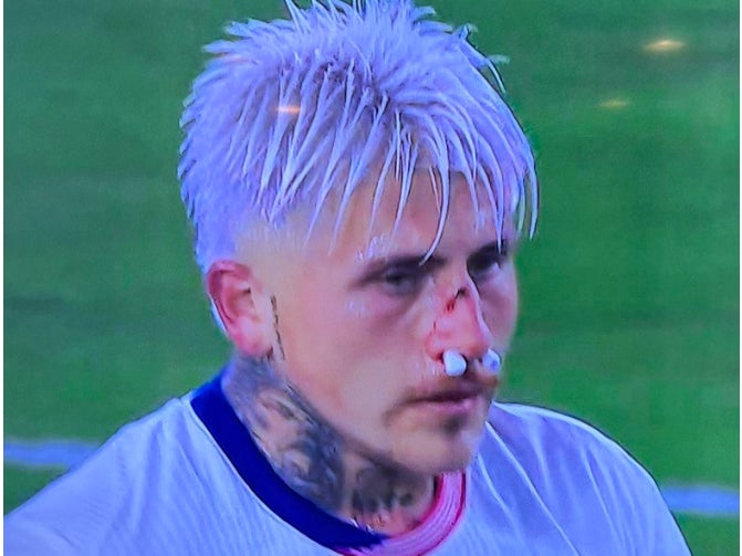 USMNT Player Breaks His Nose Mid-Game and Returns to Drop an Assist